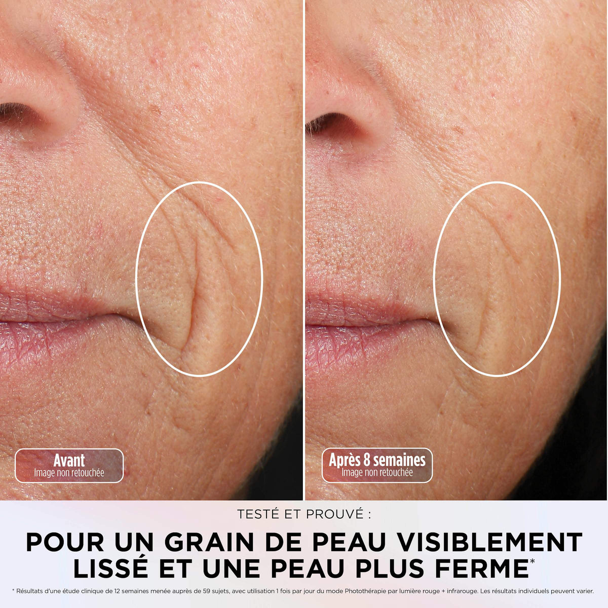 Masque LED Shark CryoGlow avec rafraîchissement du contour des yeux - Rose